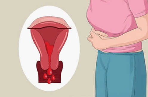10 mẹo giảm đau bụng kinh hiệu quả tại nhà