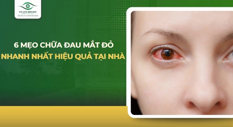 Mẹo Chữa Đau Mắt Đỏ Nhanh Nhất: Hướng Dẫn Chi Tiết Tại Nhà