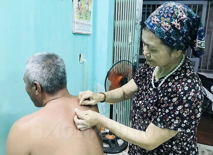 Mẹo chữa lẹo mắt bằng kim: Liệu có an toàn và hiệu quả?