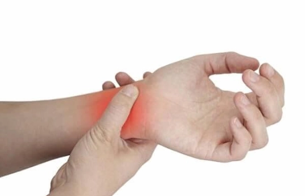 Mẹo Chữa Trật Khớp Cổ Tay Nhanh Khỏi, Phục Hồi Chức Năng